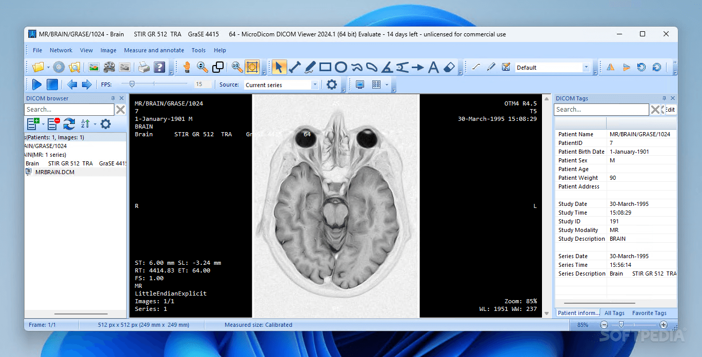 Photo #1 for MicroDicom