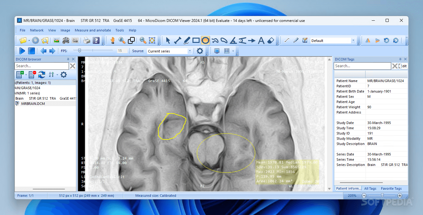 Photo #2 for MicroDicom