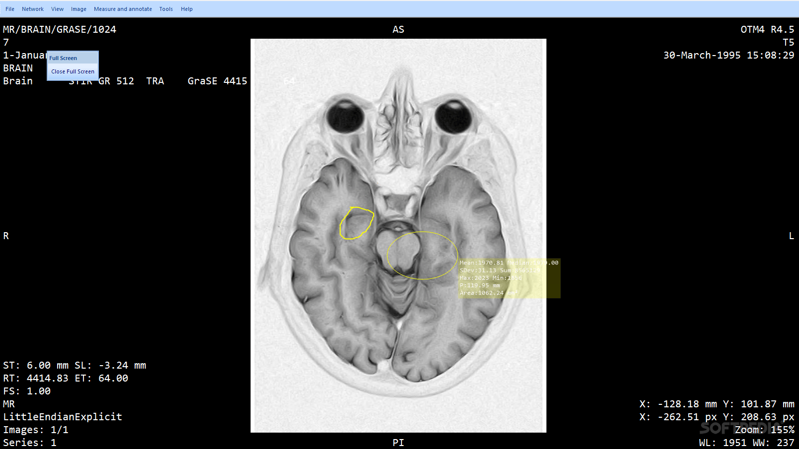 Photo #4 for MicroDicom